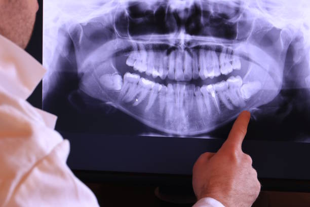 Best Emergency Dentist for Knocked-Out Tooth in Winterset, IA